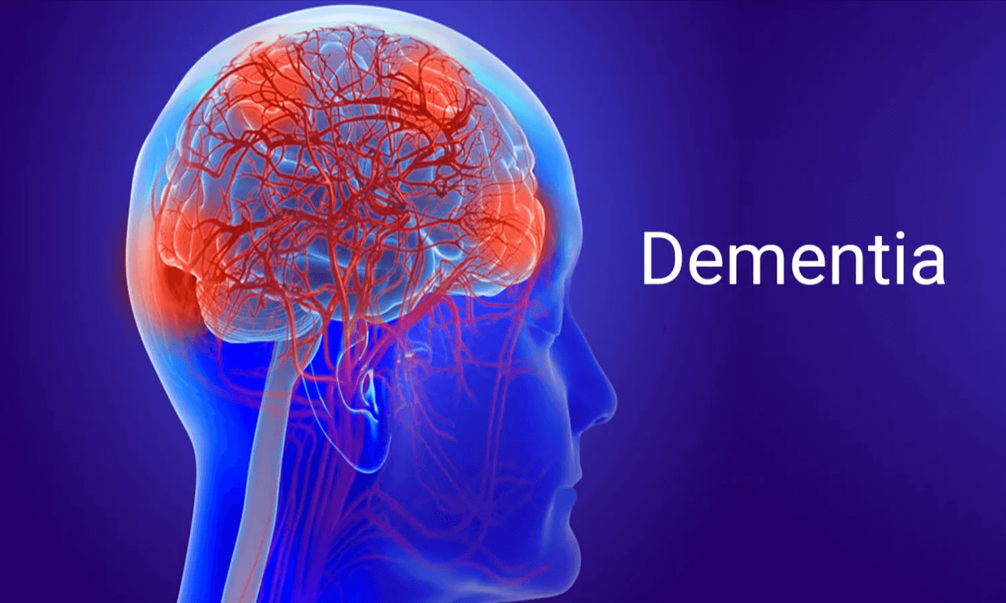 Dementia Diagnosis