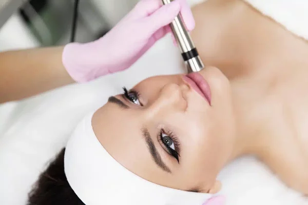 Revitalize Your Skin: Exploring the Benefits of Microneedling in Oakville